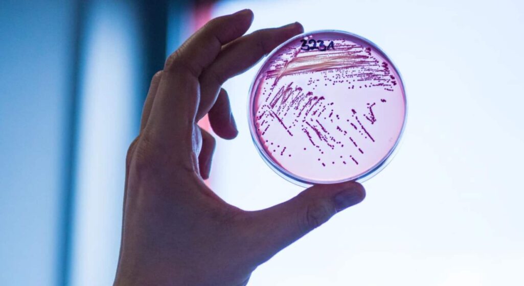 Ένα νέο αντιβιοτικό (Clovibactin) που παρασκευάζεται από βακτήρια που έχουν καλλιεργηθεί εργαστηριακά, μπορεί να σκοτώσει υπερβακτήρια χωρίς να κάνει τα μικρόβια πιο ανθεκτικά στη θεραπεία, σύμφωνα με μια πρώιμη επιστημονική μελέτη.