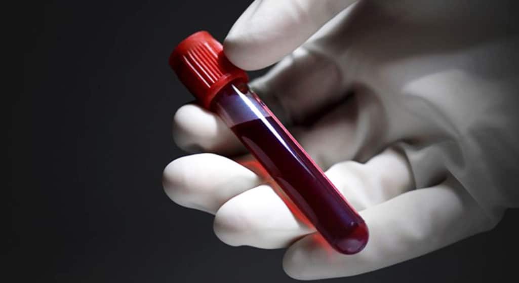 Αίμα που έχει αναπτυχθεί σε εργαστήριο έχει χορηγηθεί σε ανθρώπους, σε μια πρώτη παγκοσμίως κλινική δοκιμή, σύμφωνα με Βρετανούς ερευνητές. Μικροσκοπικές ποσότητες -που αντιστοιχούν σε δύο κουταλιές της σούπας- δοκιμάζονται για να διαπιστωθεί πώς λειτουργεί μέσα στο σώμα.