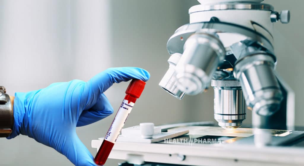 Μια νέα εξέταση αίματος για τον καρκίνο του προστάτη θα μπορούσε να γλιτώσει χιλιάδες άνδρες από περιττές βιοψίες, σύμφωνα με έρευνα που δημοσιεύτηκε στο Cancer Medicine.