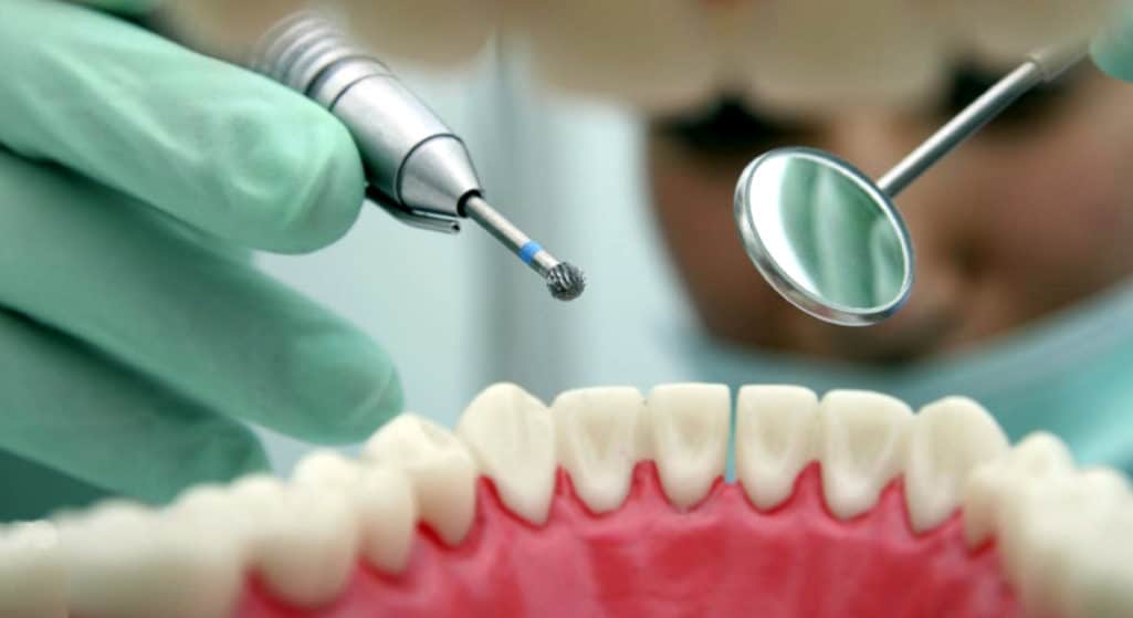 Μήνυση κατά ενός οδοντιάτρου κατέθεσε γυναίκα από τη Μινεσότα, υποστηρίζοντας πως οι 30 και πλέον οδοντιατρικές πράξεις που πραγματοποίησε ο γιατρός σε ένα και μόνο ραντεβού, της προκάλεσαν πλήθος παραμορφώσεων.