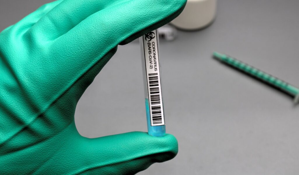 Για το σύνολο των ανεμβολίαστων που κατέληξαν από τον κορωνοϊό, εισήχθησαν στις ΜΕΘ και τα οφέλη που προσφέρει ο εμβολιασμός αναφέρθηκε ο υπουργός Υγείας Θάνος Πλεύρης.