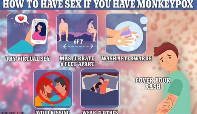 Λίστα με ιδιαίτερες οδηγίες για όσους έχουν κολλήσει ευλογιά των πιθήκων αλλά θέλουν να κάνουν σεξ, εξέδωσε το αμερικανικό CDC.