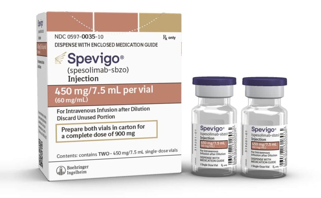 Την πρώτη άδεια φαρμάκου στην αγορά της δερματολογίας λαμβάνει η γερμανική φαρμακευτική Boehringer Ingelheim, μετά την έγκριση της Αμερικανικής Υπηρεσίας Τροφίμων και Φαρμάκων (FDA) στη θεραπεία Spevigo κατά της γενικευμένης φλυκταινώδους ψωρίασης (GPP), μιας σπάνιας, επώδυνης και απειλητικής για τη ζωή πάθησης του δέρματος, που προκαλεί επώδυνες φυσαλίδες.