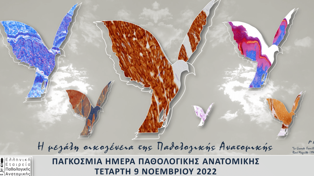 Με την ευκαιρία της Παγκόσμιας Ημέρας Παθολογικής Ανατομικής, στις 9 Νοεμβρίου 2022, η Ελληνική οικογένεια των Παθολογοανατόμων έρχεται, για μια ακόμη φορά, να σας συστηθεί και να ενημερώσει για τον εξαιρετικά σημαντικό ρόλο της, στην Ιατρική.
