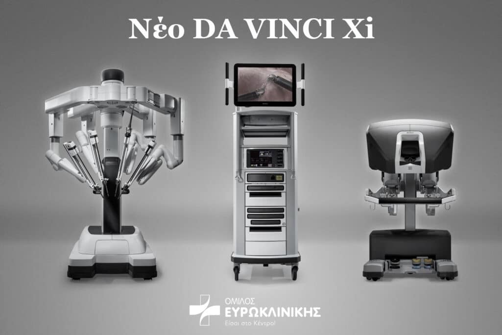 Η Ευρωκλινική Αθηνών, βελτιώνει ακόμη περισσότερο την ποιότητα των υπηρεσιών που παρέχει στους ασθενείς της, αναβαθμίζοντας τα χειρουργεία της με την εγκατάσταση του νέου υπερσύγχρονου ρομποτικού συστήματος Da Vinci Xi 4ης τεχνολογικής γενιάς.