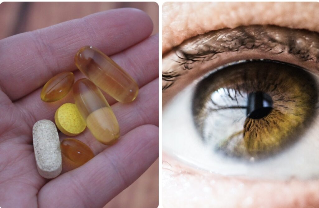 Η λήψη αντιβιοτικών φαρμάκων μπορεί να συνδέεται με την ανάπτυξη της κυριότερης αιτίας τύφλωσης των ηλικιωμένων στον δυτικό κόσμο, σύμφωνα με μία νέα μεγάλη μελέτη.