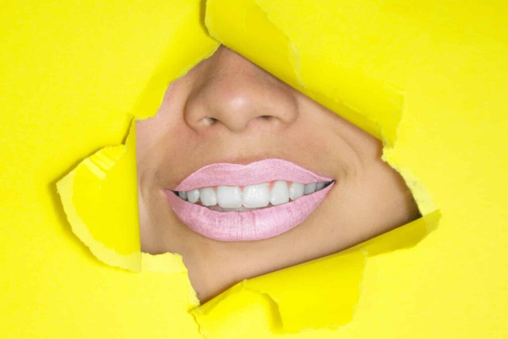 Η κίτρινη απόχρωση στα δόντια είναι ένα αισθητικό πρόβλημα που απασχολεί πολύ κόσμο